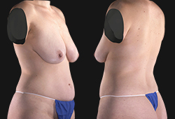 Automated face, body stitching