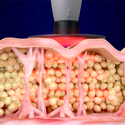 Meaningful Comparisons