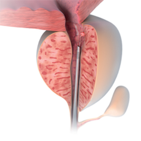 Meaningful Comparisons