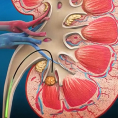 Meaningful Comparisons